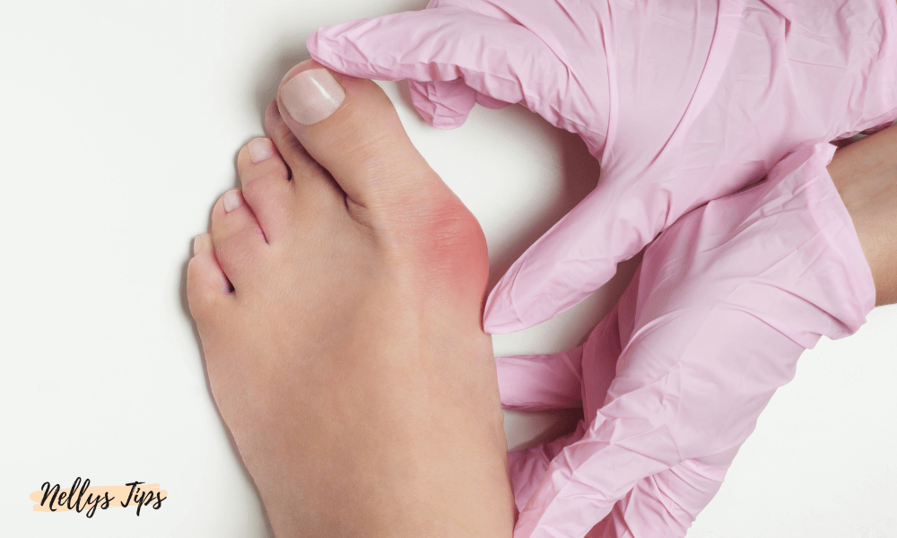 Fot med hallux valgus och rodnad, behandlas försiktigt med händer i rosa handskar.